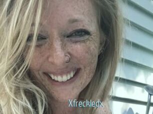 Xfreckledx